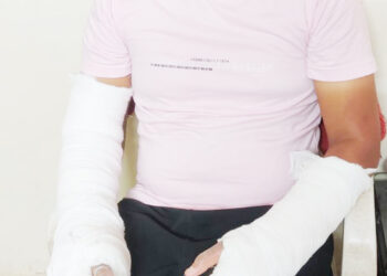 दिघ्यात खोदकाम करताना गॅस पाईन लिकेज होऊन आग : एक भाजला; एक गाडी जळाली