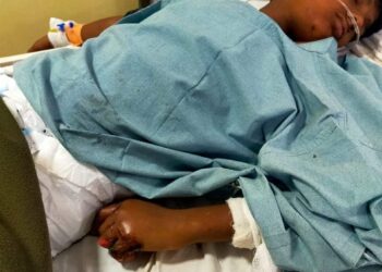 सानपाडा येथे महापालिका कंत्राटदार व अधिकाऱ्यांच्या निष्काळजपणामुळे १३ वर्षीय मुलाला वीजेच्या धक्क्यात मुलाने गमावली ३ बोटे