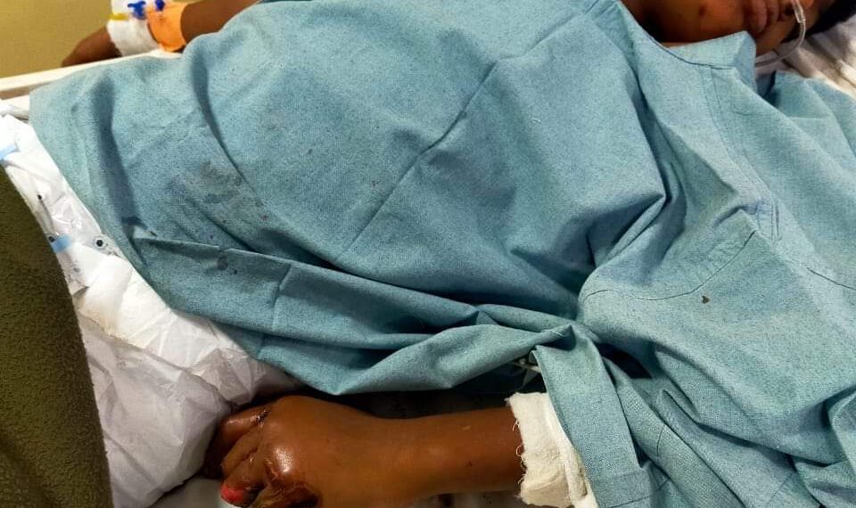 सानपाडा येथे महापालिका कंत्राटदार व अधिकाऱ्यांच्या निष्काळजपणामुळे १३ वर्षीय मुलाला वीजेच्या धक्क्यात मुलाने गमावली ३ बोटे